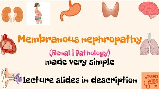 Membranous nephropathy  Renal  Pathology  Med Vids made simple [upl. by Kersten101]