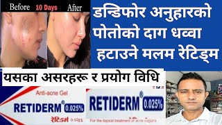 Retidrem 025tretinoin in Nepali।डन्डिफोरको दाग अनुहारको कालो चायाॅं पोतो हटाउने मलमacne [upl. by Iams]