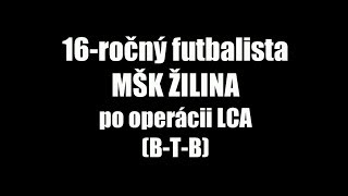 FYZIOTERAPIA PO OPERÁCII LCA  Vladimír Barbora [upl. by Hercule]