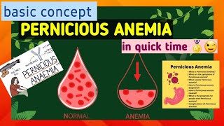 Pernicious anemia  what is anemia  cause  symptoms  treatment [upl. by Erehpotsirhc]