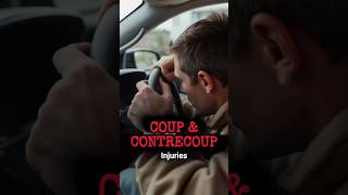 Coup and Contrecoup Head Injury shorts youtubeshorts [upl. by Gisser]