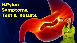 HPylori Test in Hindi  Symptoms Test and Results in Hindi [upl. by Gilges]