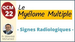 Myélome Multiple Signes Radiologiques  Hématologie QCM 22 [upl. by Enyala]