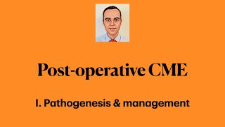 Postoperative Cystoid Macular Edema I Pathogenesis amp management [upl. by Sion227]