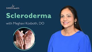 Scleroderma Early Signs amp Symptoms [upl. by Nayarb]