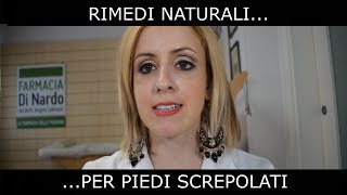 Talloni screpolati Rimedi pratici [upl. by Ellehsar]