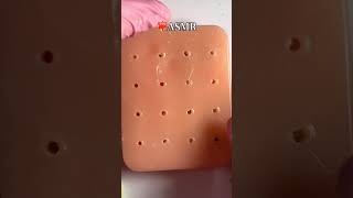 ASMR ear cleaning asmrsounds asmr blackdots asmrcosmetologist viral skincare acnetreatment [upl. by Medlin]