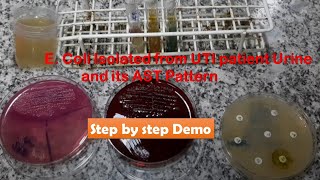 E coli Isolation from Urine Culture of Suspected UTI patient and Sensitivity Test [upl. by Eornom]