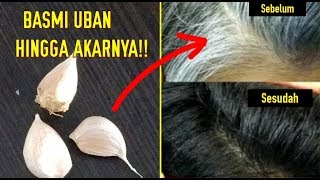 Bikin Kaget Sekali Usap Uban Dan Rambut Putih Hilang Seketika [upl. by Eda]