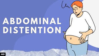 Abdominal Distention Everything You Need To Know [upl. by Lowe]