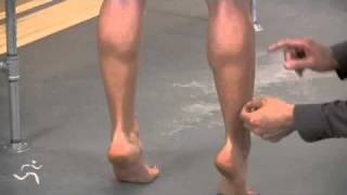 Calf Pain fix example video [upl. by Yarised389]