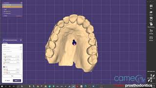 Exocad 30 Galway  How to Make Models from Trios Scans Presented by Boise Prosthodontics [upl. by Adnilrev716]