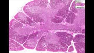 Histologia Humana  Timo [upl. by Mccomb]