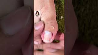 Satisfying Toe Cleaning  Relaxing Foot Care amp Deep Clean ASMR 80 [upl. by Noevad942]