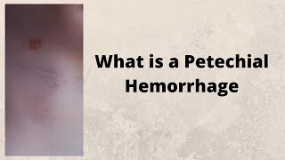 What is a Petechial Hemorrhage [upl. by Nimrahc]