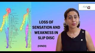 LEG WEAKNESS IN BACK PAIN HINDI  DERMATOMES AND MYOTOMES [upl. by Ellinehc]