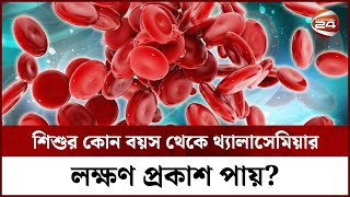 শিশুর কোন বয়স থেকে থ্যালাসেমিয়ার লক্ষণ প্রকাশ পায়  Thalassemia Symptoms  Channel 24 [upl. by Llekram583]