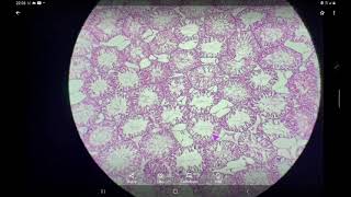 Testis  Histology slide identification and explanation [upl. by Meeharbi]