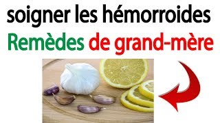 Comment soigner les hémorroides avec des remèdes de grandmère [upl. by Whit263]