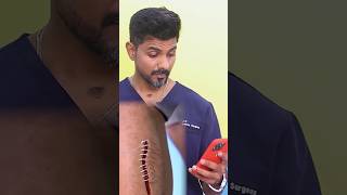 Dr Charan Reacts to AtHome Suture System Zip Stitch Safe or Scam glowwithdrcharan aesthetiq [upl. by Chambers37]