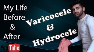 Varicocele treatment  My Story about Varicocele amp Hydrocele after amp before  without surgery amp med [upl. by Aeikan]