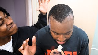 My Family DESTROYED My Hairline Surgery [upl. by Pfeffer]