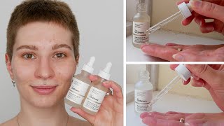 How to use The Ordinary Alpha Arbutin and Niacinamide together [upl. by Ardnua548]