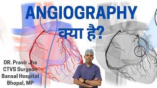 What is Angiography  Angiography kab karwayen  Dr Pravir Jha [upl. by Aleacem]