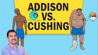 Addisons vs Cushings Disease for NCLEX RN [upl. by Shelagh436]