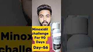 Minoxidil challenge For 90 DaysDay56 haircare minoxidil viralreels viralshorts trendingshorts [upl. by Marti]