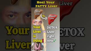 Detox drink for fatty liver  Fix fatty liver with this drink [upl. by Chelsie]