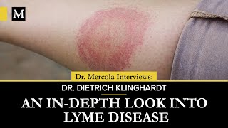 An InDepth Look Into Lyme Disease – Interview With Dr Dietrich Klinghardt [upl. by Harbour]