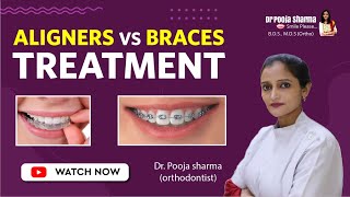 Aligners vs Braces Treatment  Which is best Orthodontic in Agra India  Dr Pooja Sharma [upl. by Iggem]