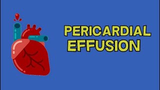 PERICARDIAL EFFUSION [upl. by Eikcor188]