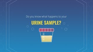 Do you know what happens to your urine sample [upl. by Aubyn106]