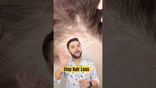 100 Ayurvedic Secret to Stop Hair Fall Hair Growth Challenge [upl. by Harihat835]