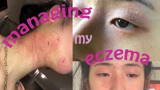 GRWM for Eczema Prone Skin – Skincare amp Makeup [upl. by Heriberto279]