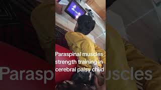 Paraspinal strengthening of cerebral palsy patient physiotherapy cerebralpalsy spine pakistan [upl. by Orofselet]