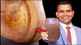 Eat Chia Seeds To Lose Weight Fast  Best Way To Eat Chia Seeds For Quick Weight loss [upl. by Foskett]