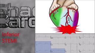 12 Lead EKG Practice Part One [upl. by Lias250]