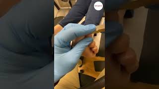 How To Cut Your Toenails  Podiatrists View [upl. by Cook]