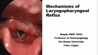 Mechanisms of Laryngopharyngeal Reflux [upl. by Einnim]