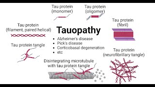 Microglial activation and tau transmission aggravated by Galectin3 in tauopathy [upl. by Ennayar]