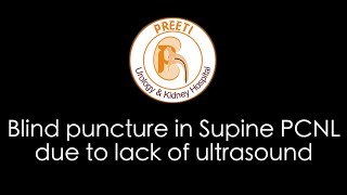 Blind puncture in Supine PCNL due to lack of Ultrasound [upl. by Afaw]