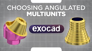 Exocad tutorial  Choosing angulated multi units  How to work with ExoCad library [upl. by Eiramave550]