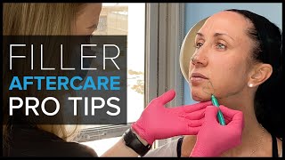 What Happens After a Filler Treatment Bruises Swelling and Aftercare Tips [upl. by Ymor]