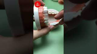 Fix your chipped or broken teeth at home easy DIY TOOTH BONDING  Life Hacks Box [upl. by Rebhun]