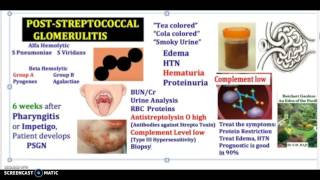 3 Minutes Poststreptococcal Glomerulitis Causes Symptoms Diagnosis Treatment ASGN PSGN USMLE NCLEX [upl. by Good]