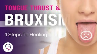 The Surprising Connection Between TONGUE THRUST and BRUXISM Revealed [upl. by Ame]