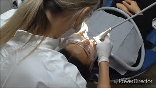 Dental hygienist visit female patient [upl. by Rilda]